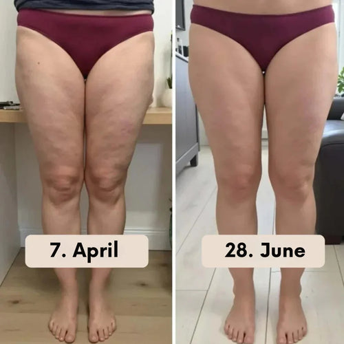 Cellulite Massage Oil