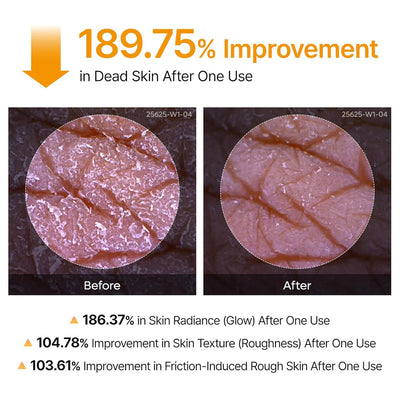 Turmeric Body Peel Shot