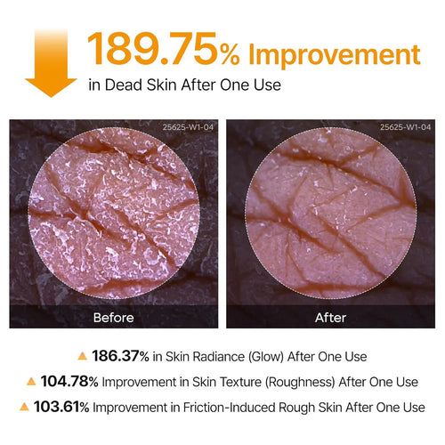 Turmeric Body Peel Shot