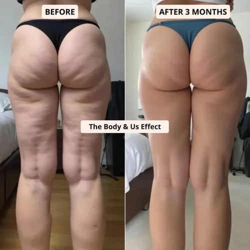 Cellulite Massage Oil