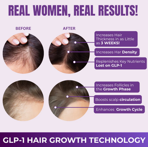 Hair Growth Accelerator